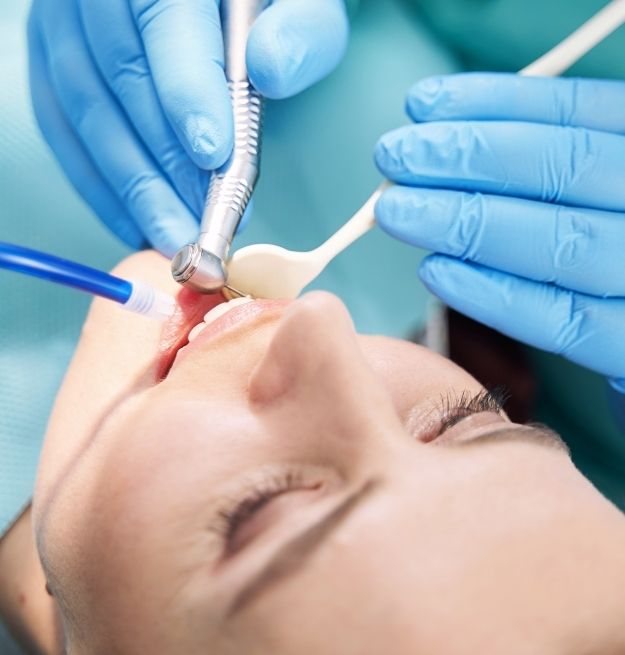 Root Canal treatment Alameda