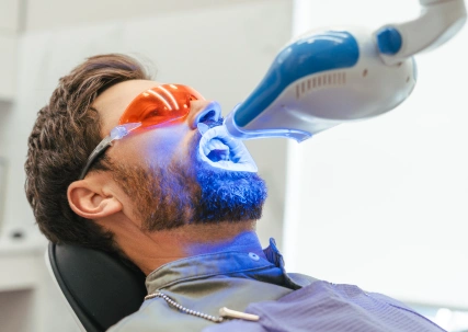 Zoom teeth whitening Alameda